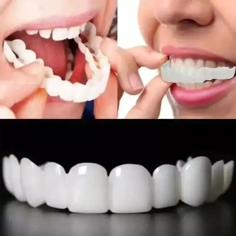 Snap-On Smile 2nd Gen Silicone Whitening Dentures